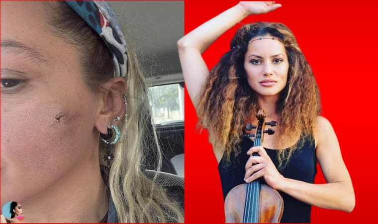 EŞİM TARAFINDAN DARP EDİLDİM